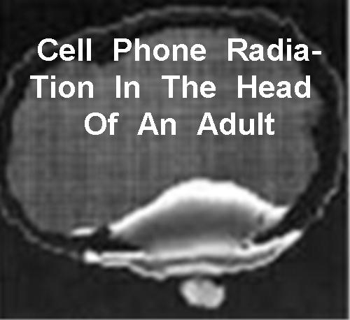 [Cell Phone Radiation Penetration of An Adult Head]